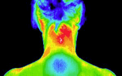 EXCITING NEWS! Preventative Screening Offers You Peace of Mind